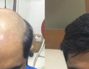 beforeafter1