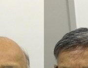 beforeafter2
