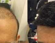 beforeafter5