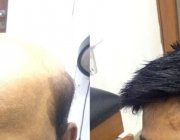 beforeafter6