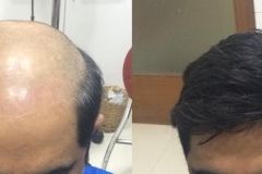 beforeafter1