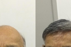 beforeafter2