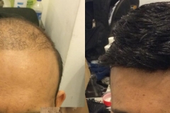 beforeafter5