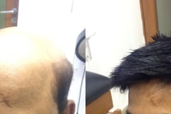 beforeafter6